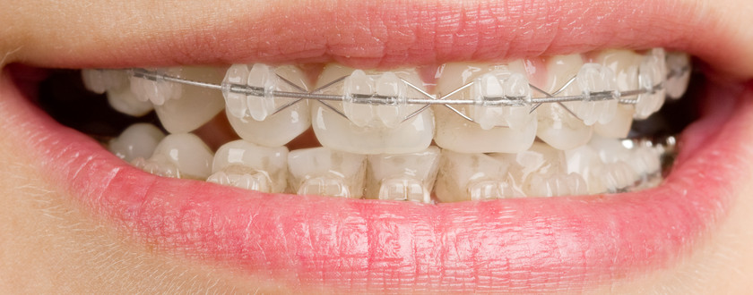 Diento Oral Health Care